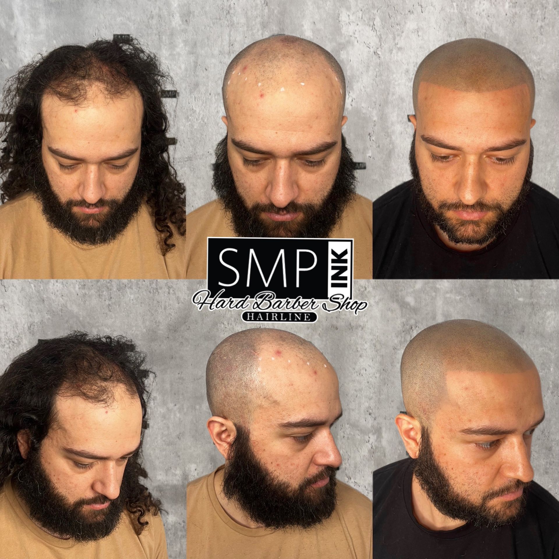 Six views of a bald man with a beard haircut, from long hair to a close shave, with SMP watermark.