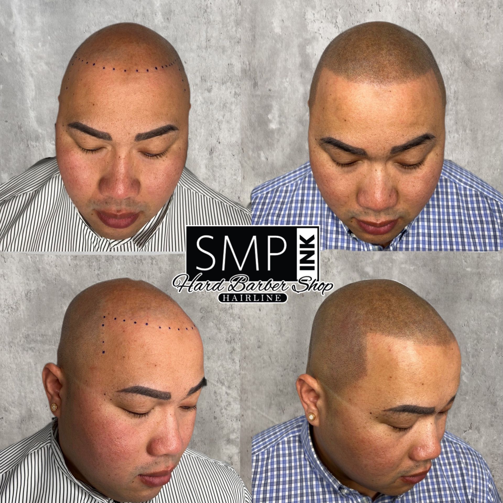 Four-panel close-up of a shaved scalp with dark eyebrow tattoos, showing before-and-after angles.