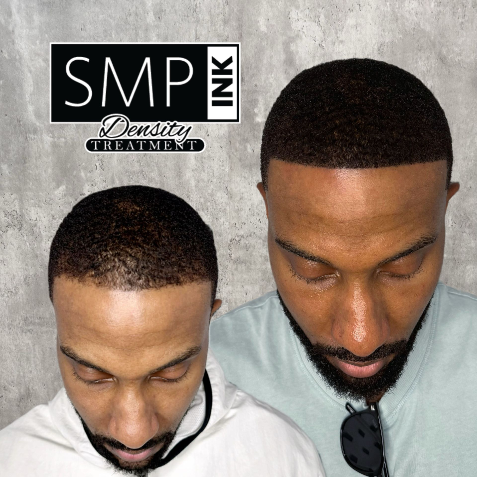 Before-and-after top-down photos of a man’s haircut with an SMP Ink Density Treatment label.