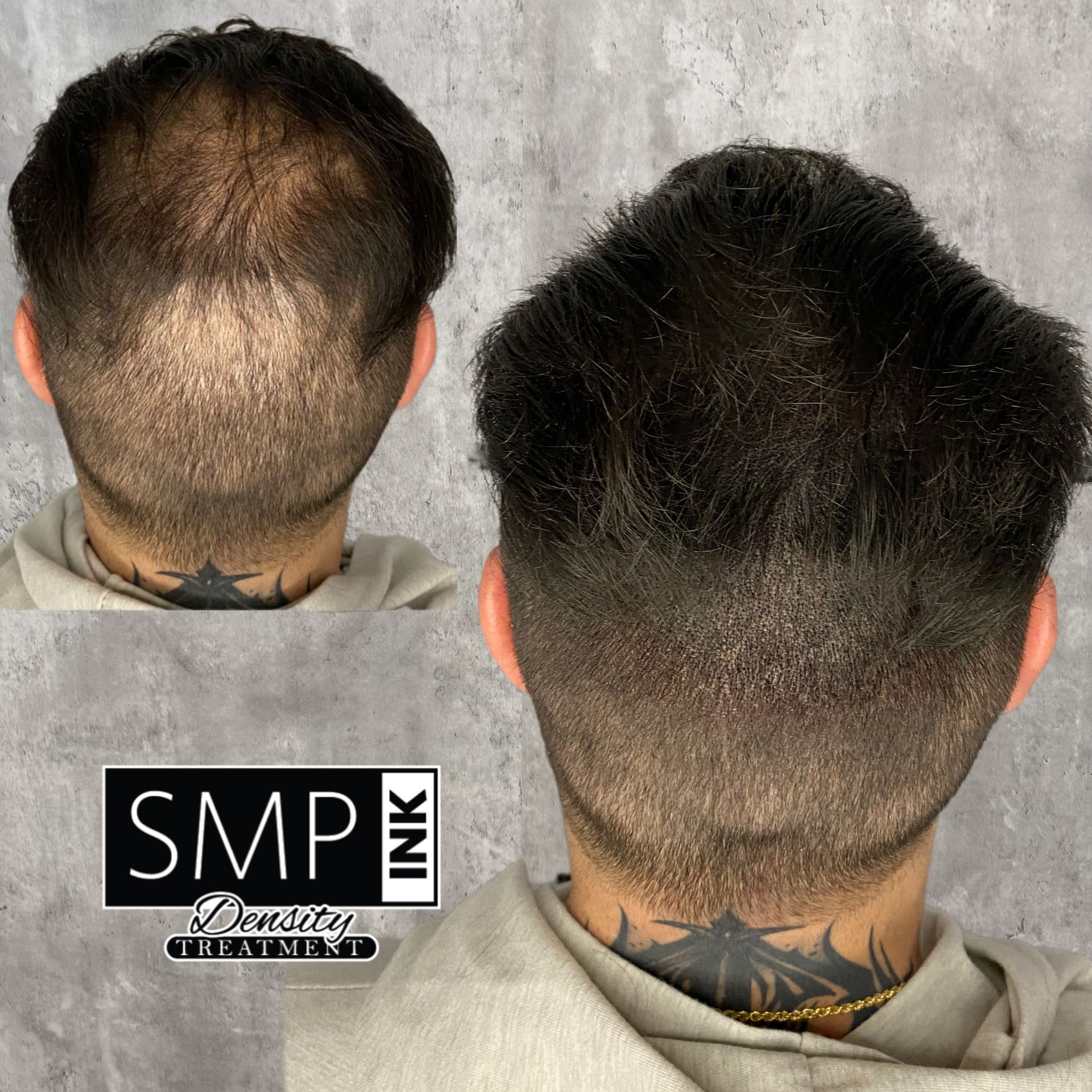 SMP Density Fill | SMP INK | Las Vegas