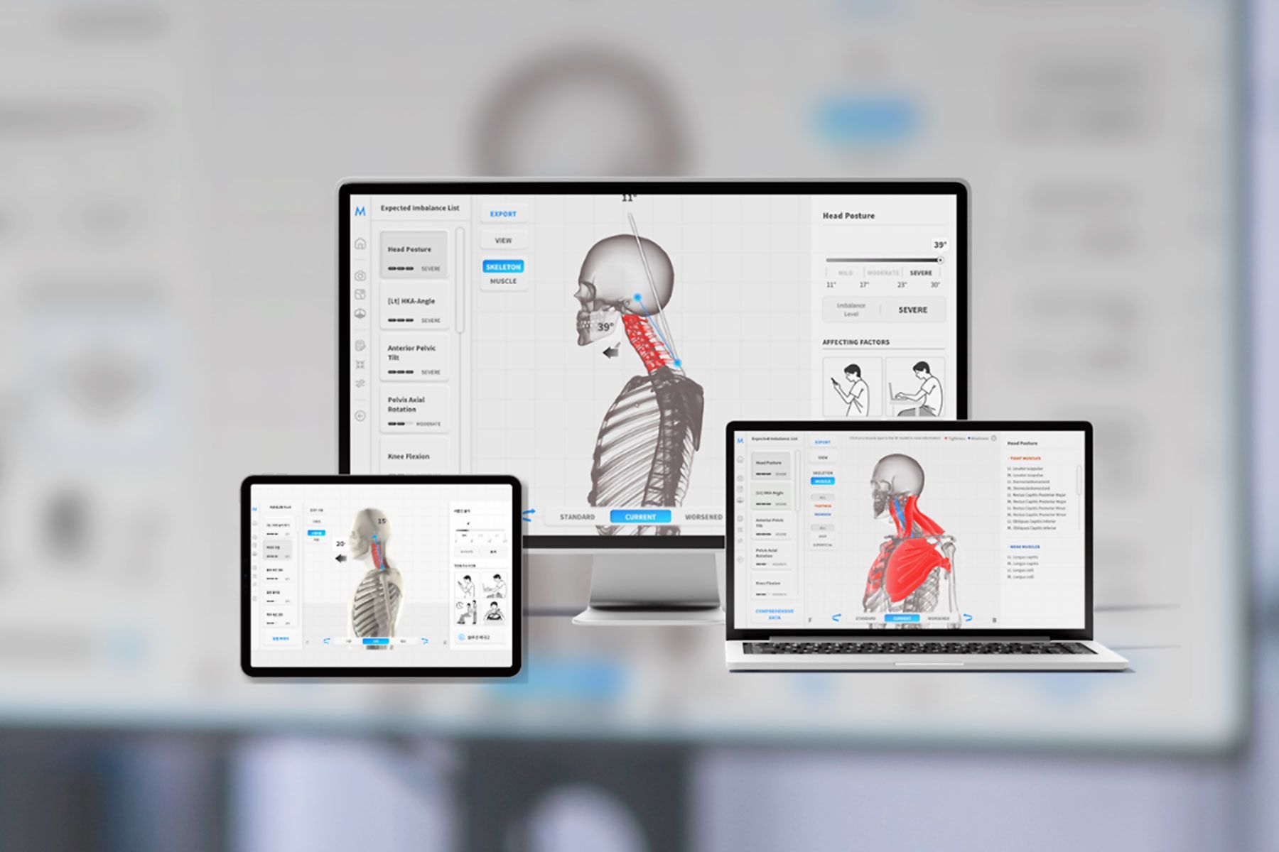 MOTI PHYSIO