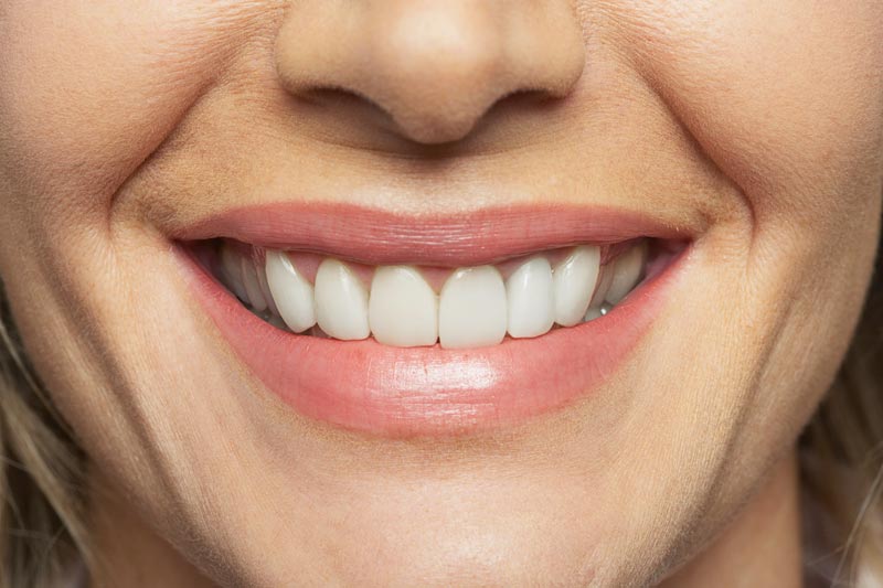 Woman's Smile — Orange, CT — New England Dental Health Services PC Woman's Smile — Orange, CT — New England Dental Health Services PC