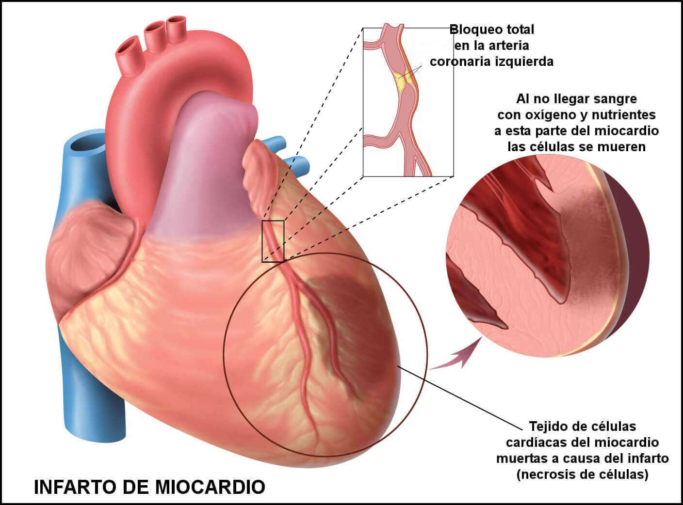 DR. LEOCADIO G. MUÑOZ BELTRAN - Enfermedades del corazón