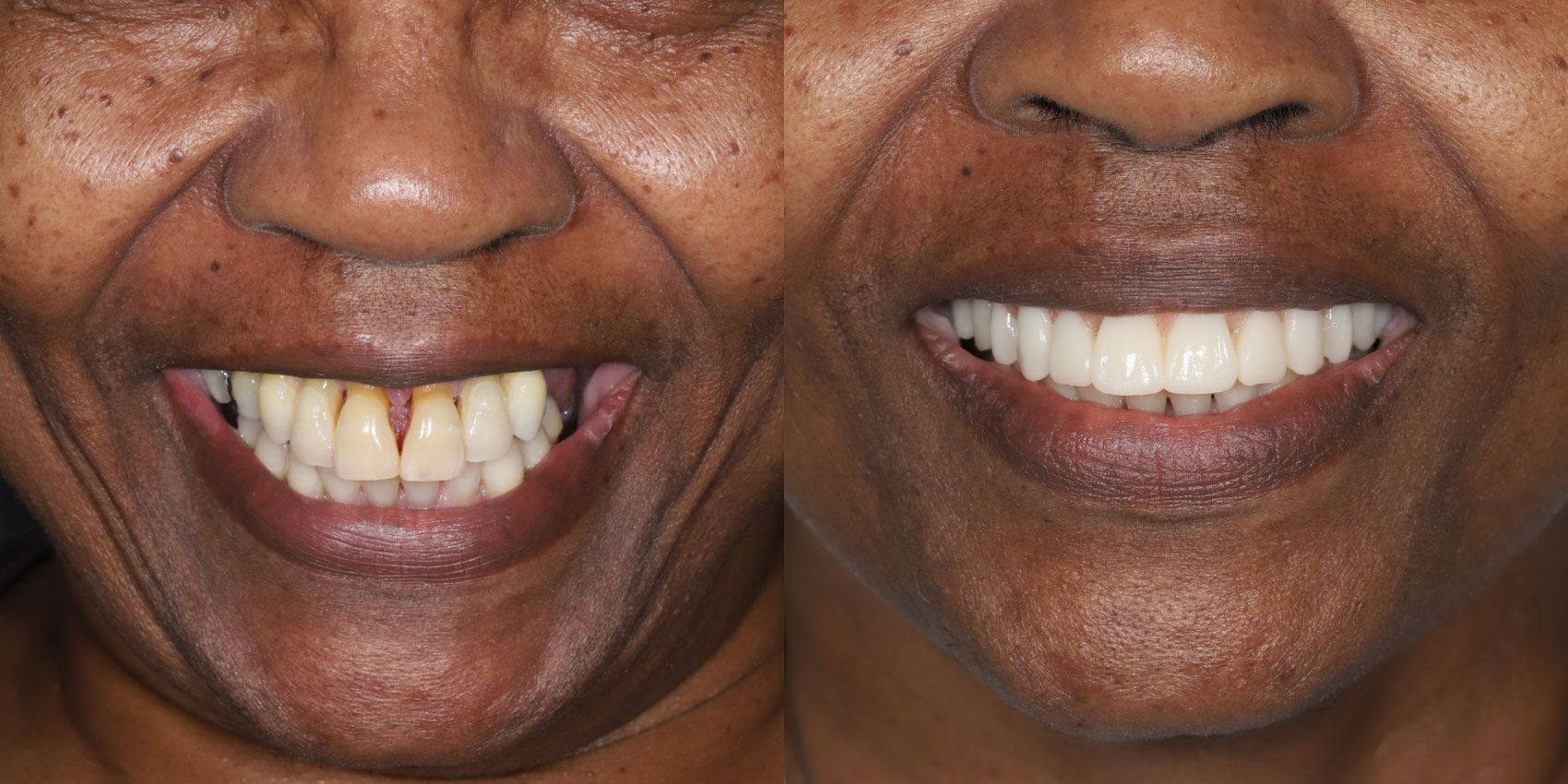 Before and After Margaret