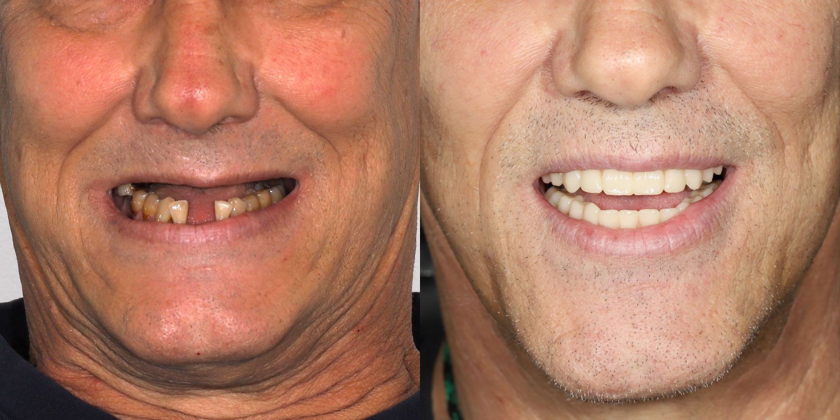 Before and After Salihar