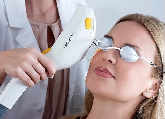 OptiLight, IPL, Dry Eye, Skin Rejuvenation, Aesthetics