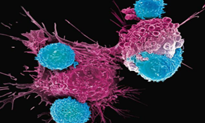 Oncoematologia