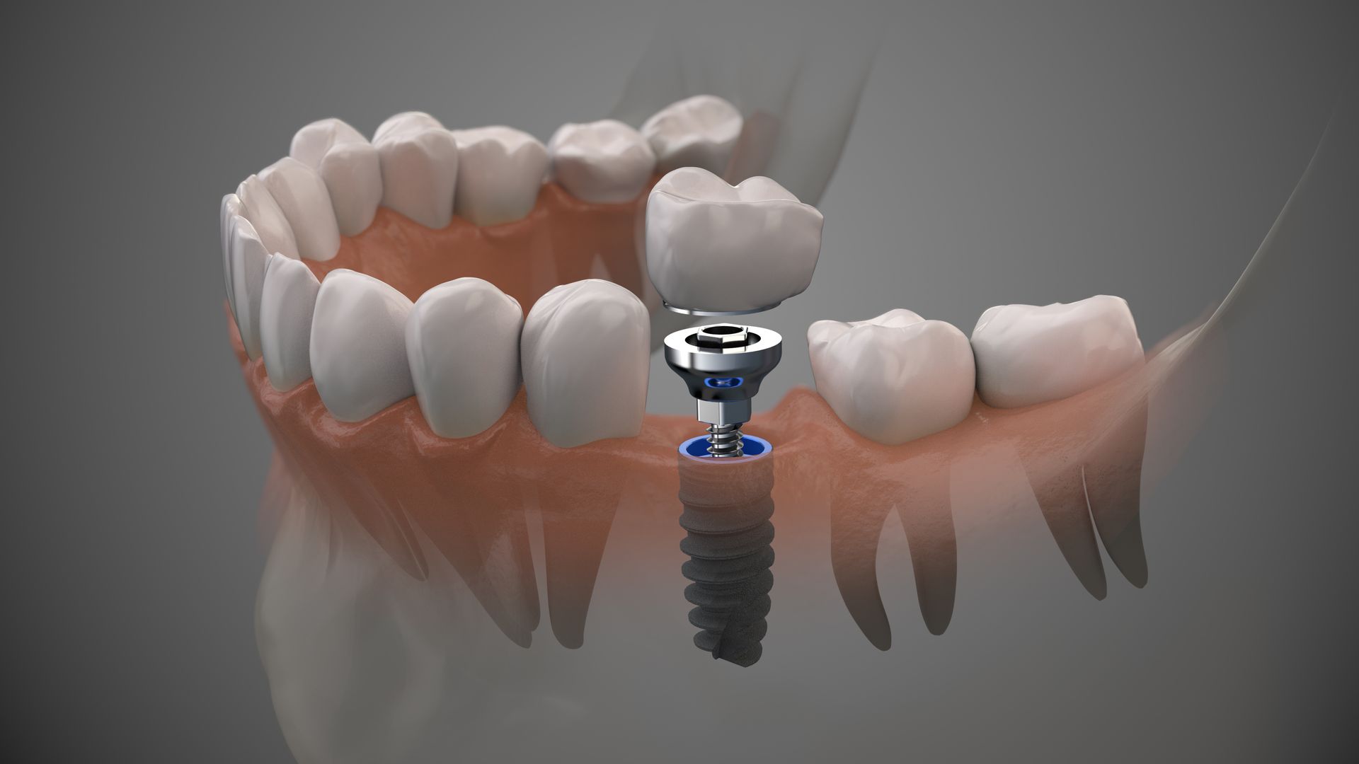 Titanium Mobile 3D Scan Titanium Mobile 3D Scan