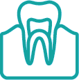 endodontinis gydymas