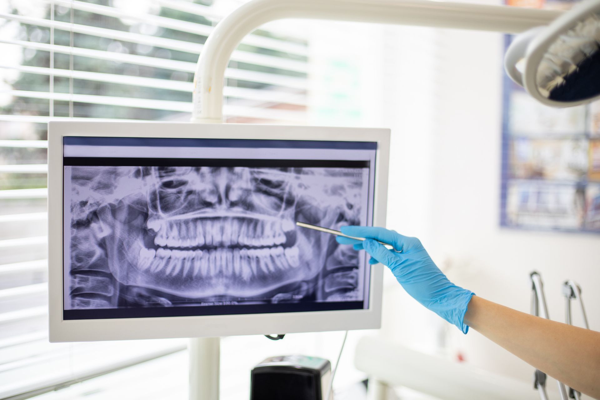Dental X-Ray — Hornsby, NSW — Smile Health Dental Care