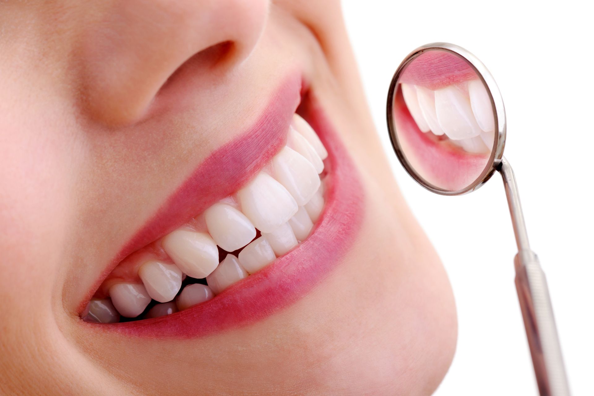 Scale & Clean Dentistry — Hornsby, NSW — Smile Health Dental Care