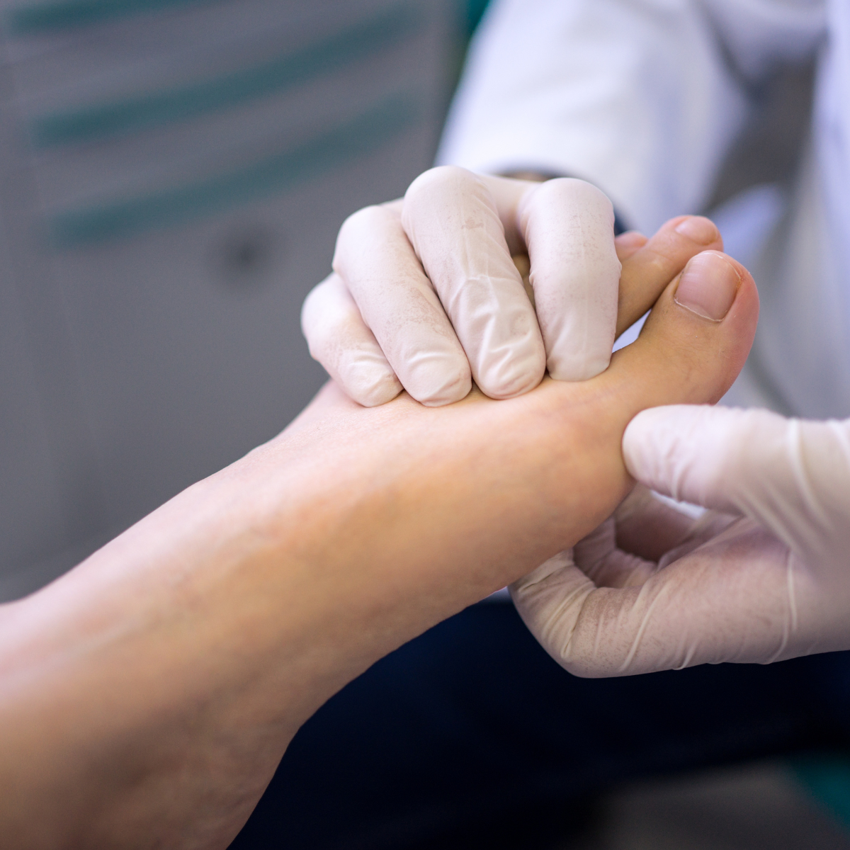 General Foot Care