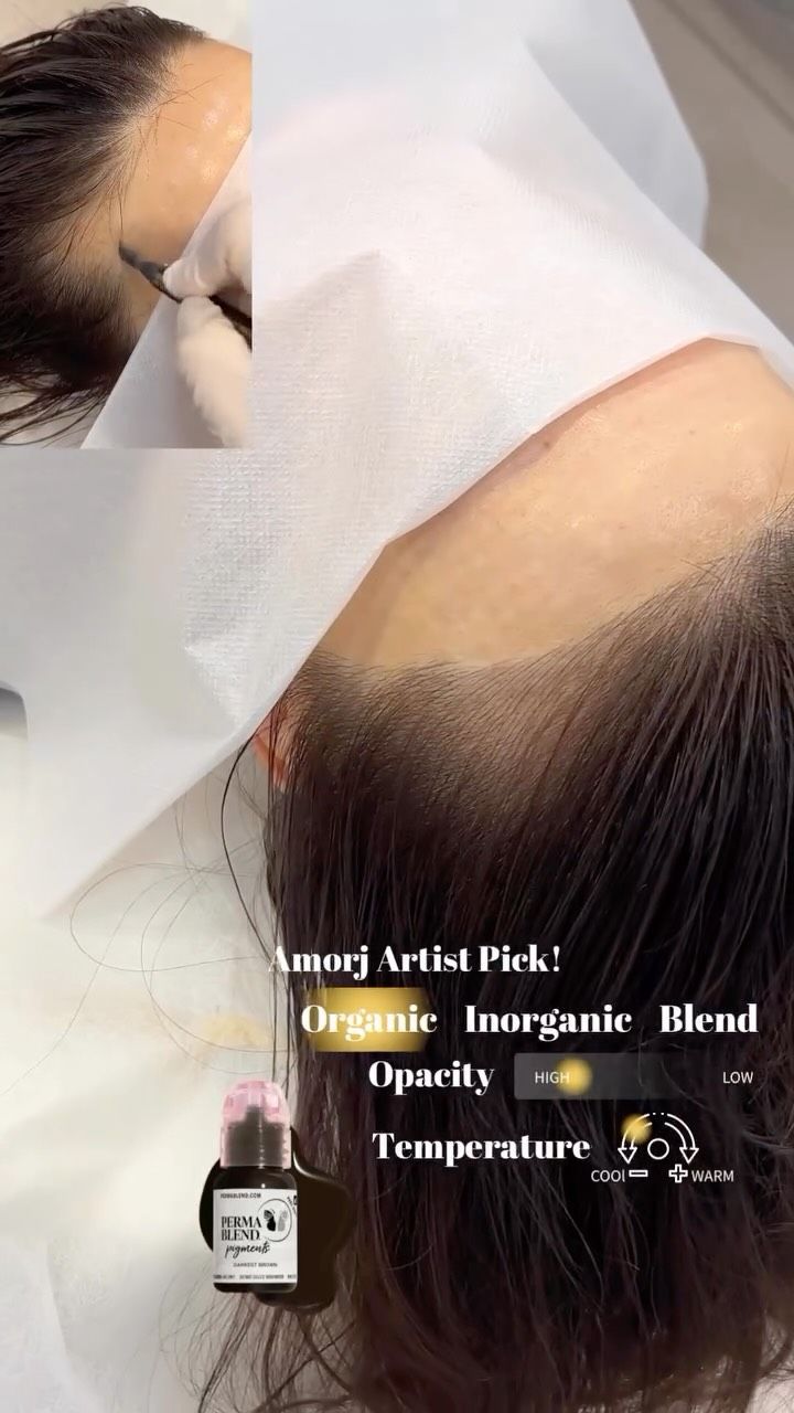 Person's scalp with a hairline being tattooed. A gloved hand works on the skin, near a bottle of pigment.