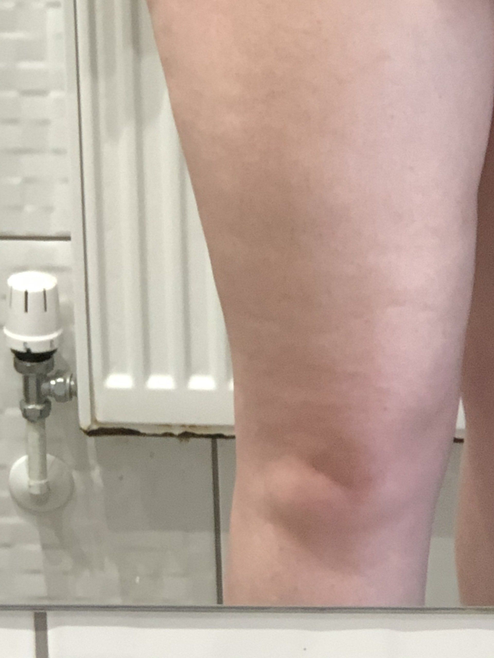Skinade targeted solutions cellulite after