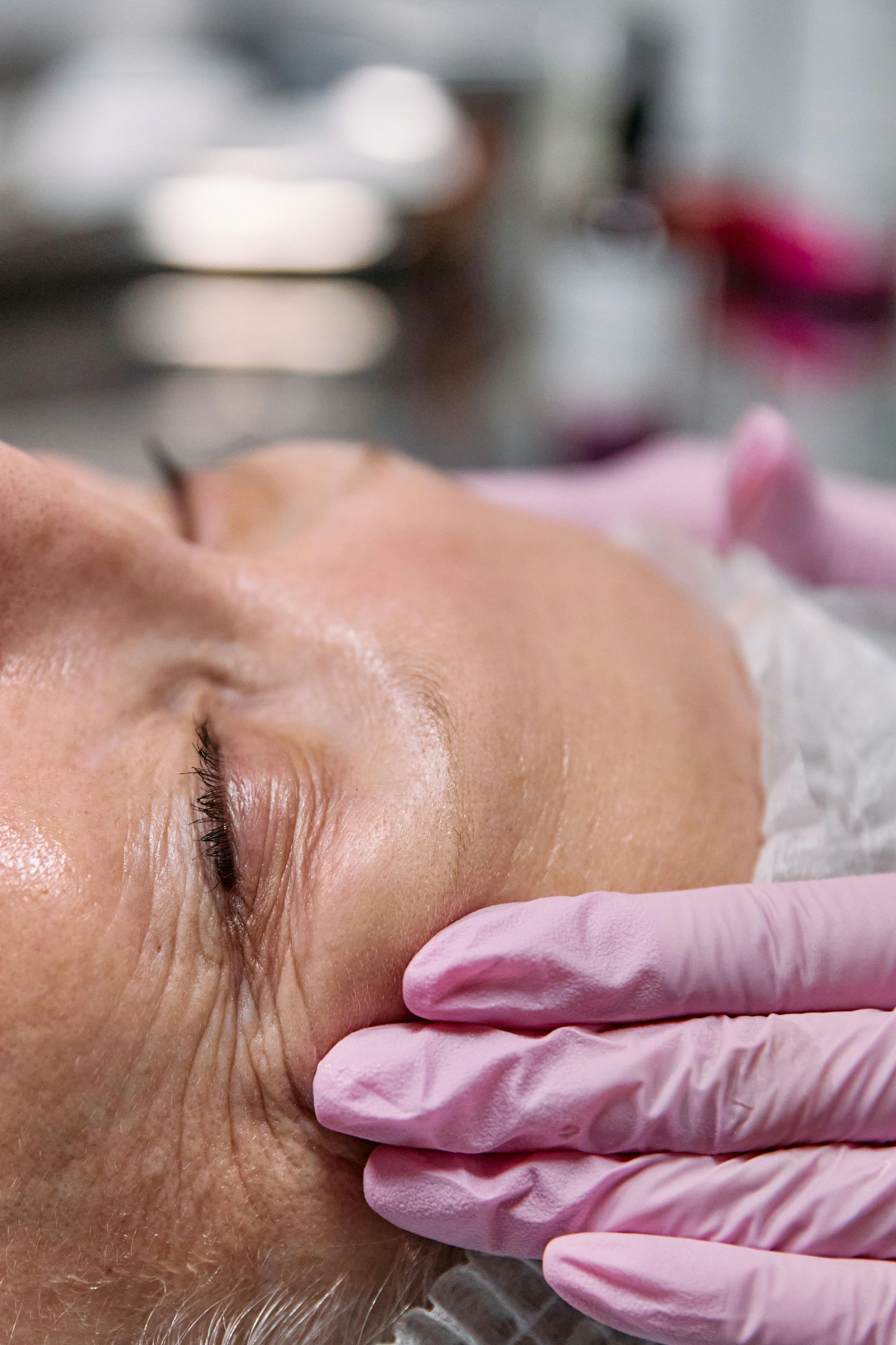 An Elu Med Spa patients receives a Chemical Peel in Marlborough, MA.