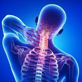 illustration of xray of spine