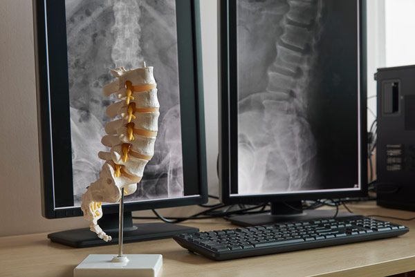 Back pain treatment Jacksonville FL