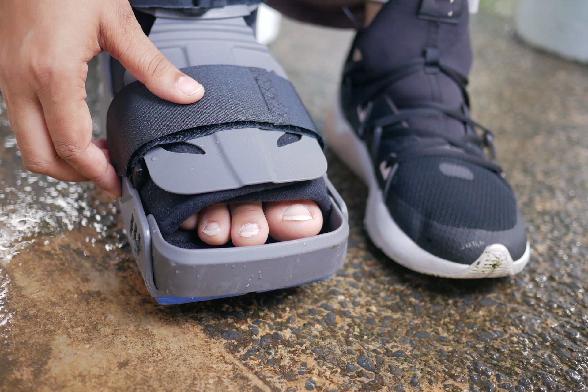 Foot pain and injury treatment in Jacksonville, FL. Call North Florida Spine and Injury Center