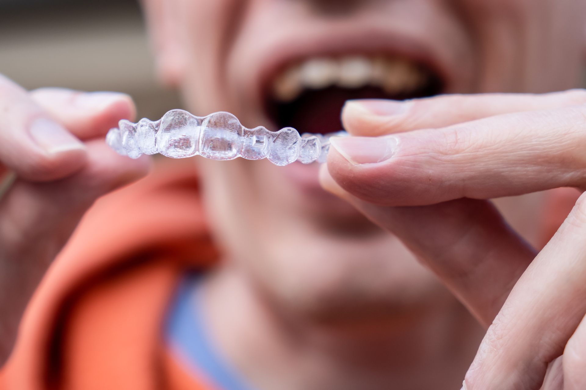 Person holding clear aligner near open mouth, ready to insert.