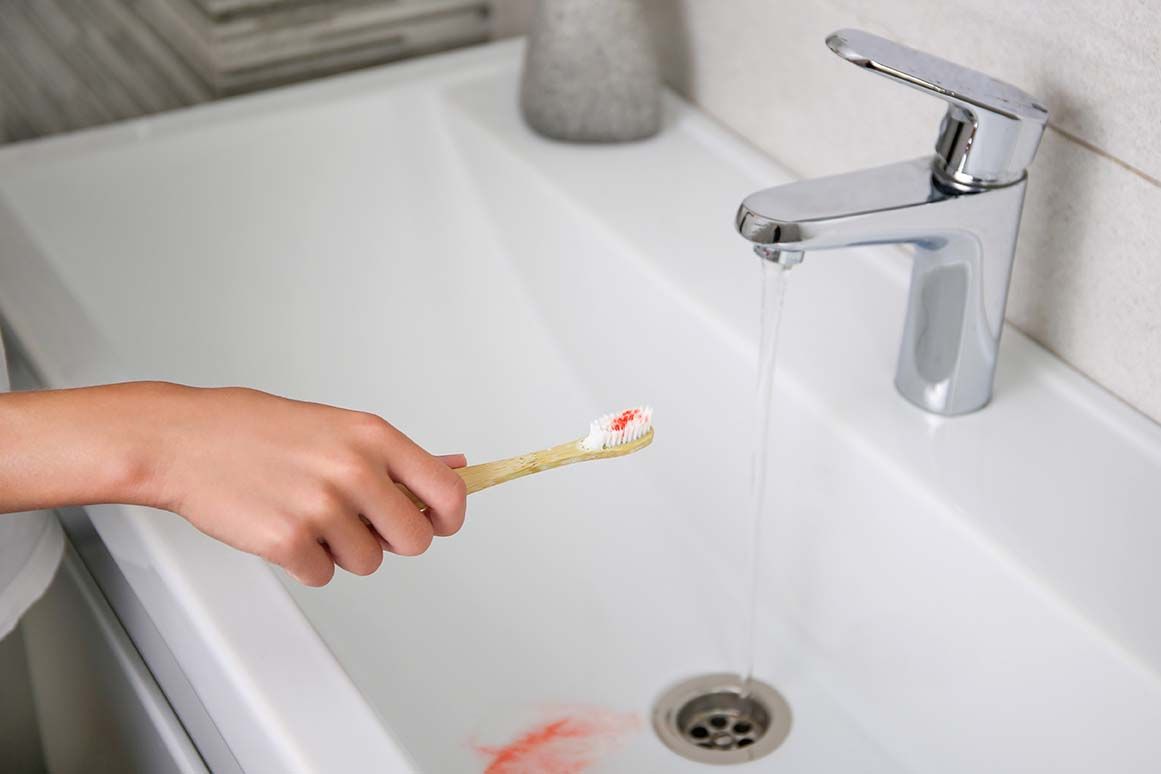 bleeding gums after brushing teeth