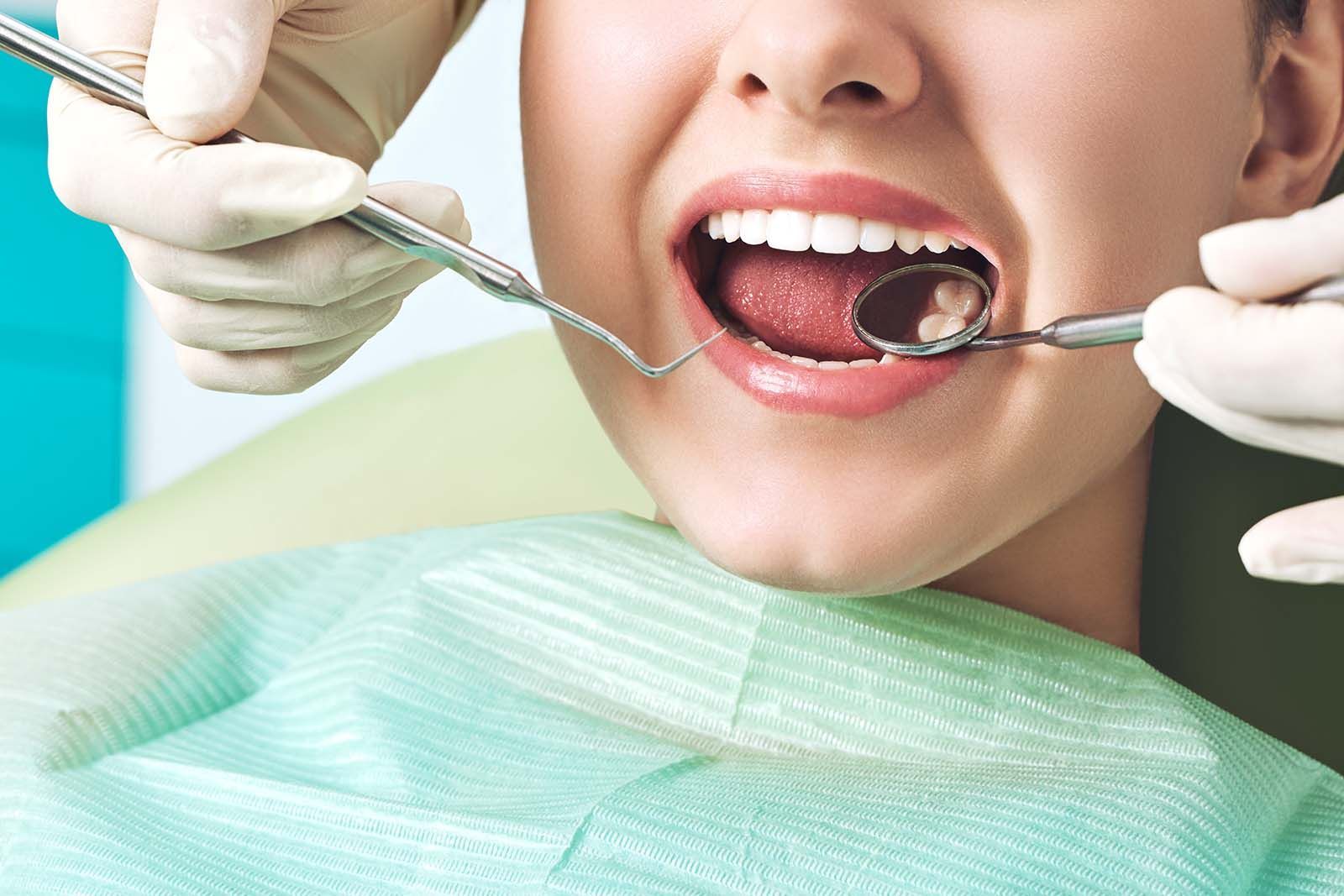 composite filling replacement at Babylon NY dental office