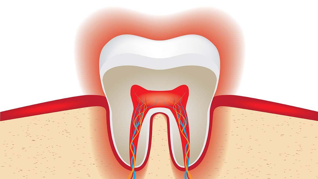 illustration showing sensitive tooth pain. 