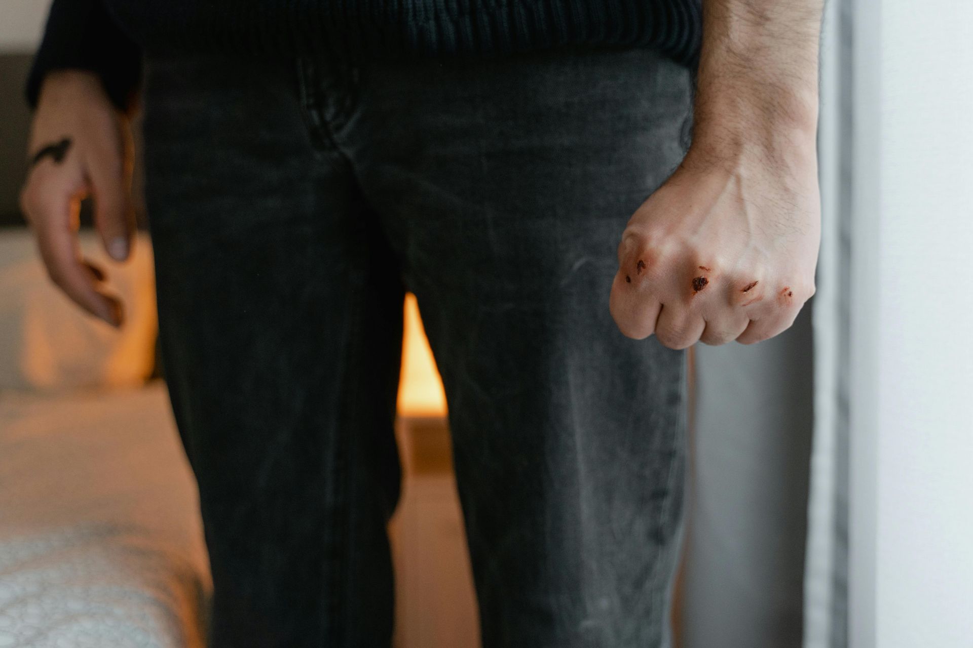 A person wearing dark jeans and a sweater stands with their right hand clenched into a fist, showing small cuts on knuckles.
