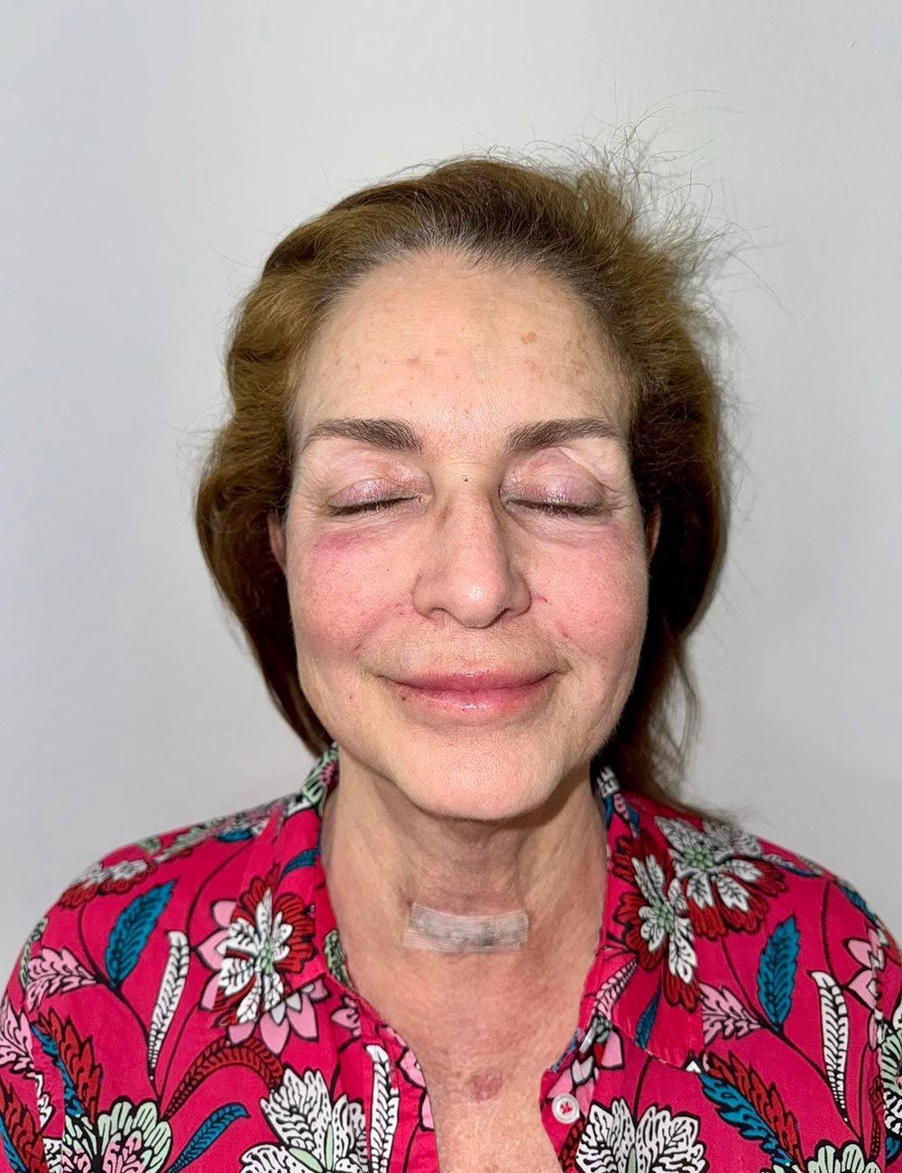 Portrait of a person with closed eyes, wearing a bright pink floral top against a plain background