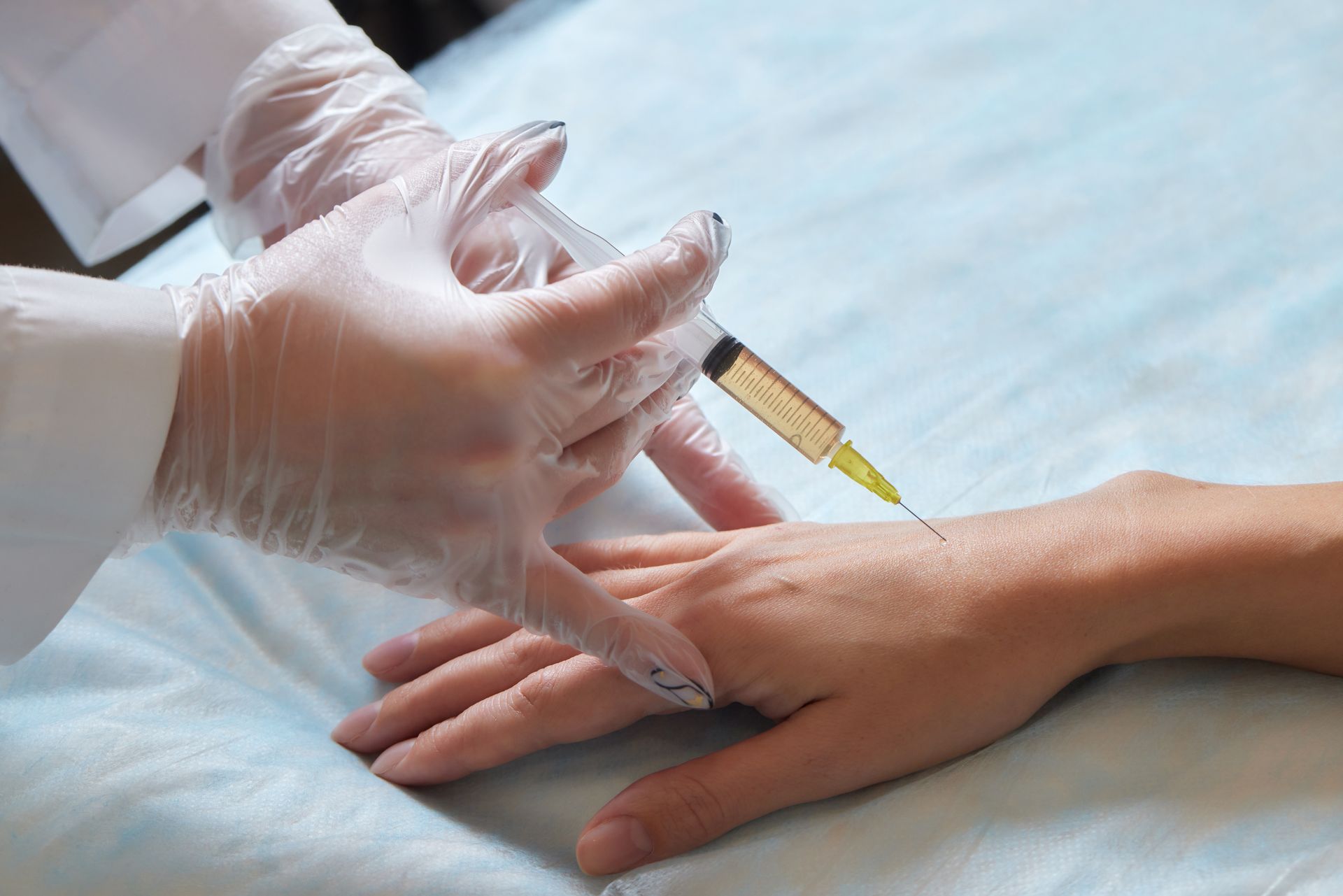 Gloved hands injecting liquid into a person’s hand with a syringe on a blue medical drape