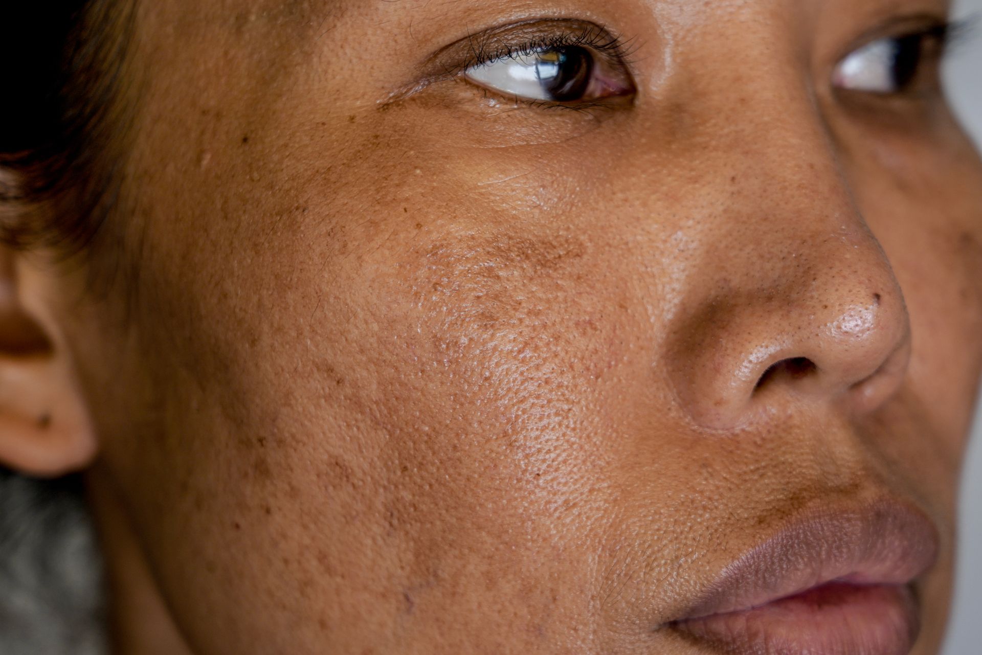 Close-up of a person’s face with visible skin texture and a neutral expression