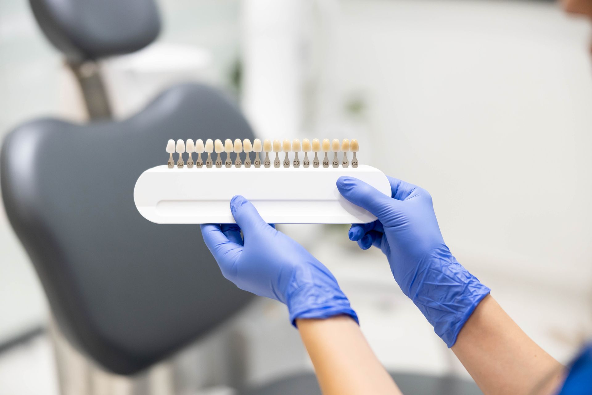 Hands in blue gloves hold a teeth shade guide in a dental office.
