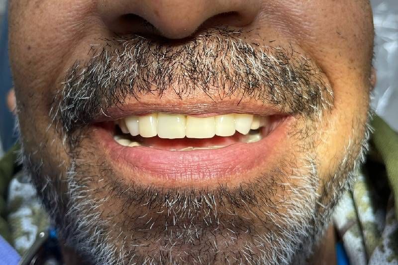 A man with a beard and white teeth is smiling.