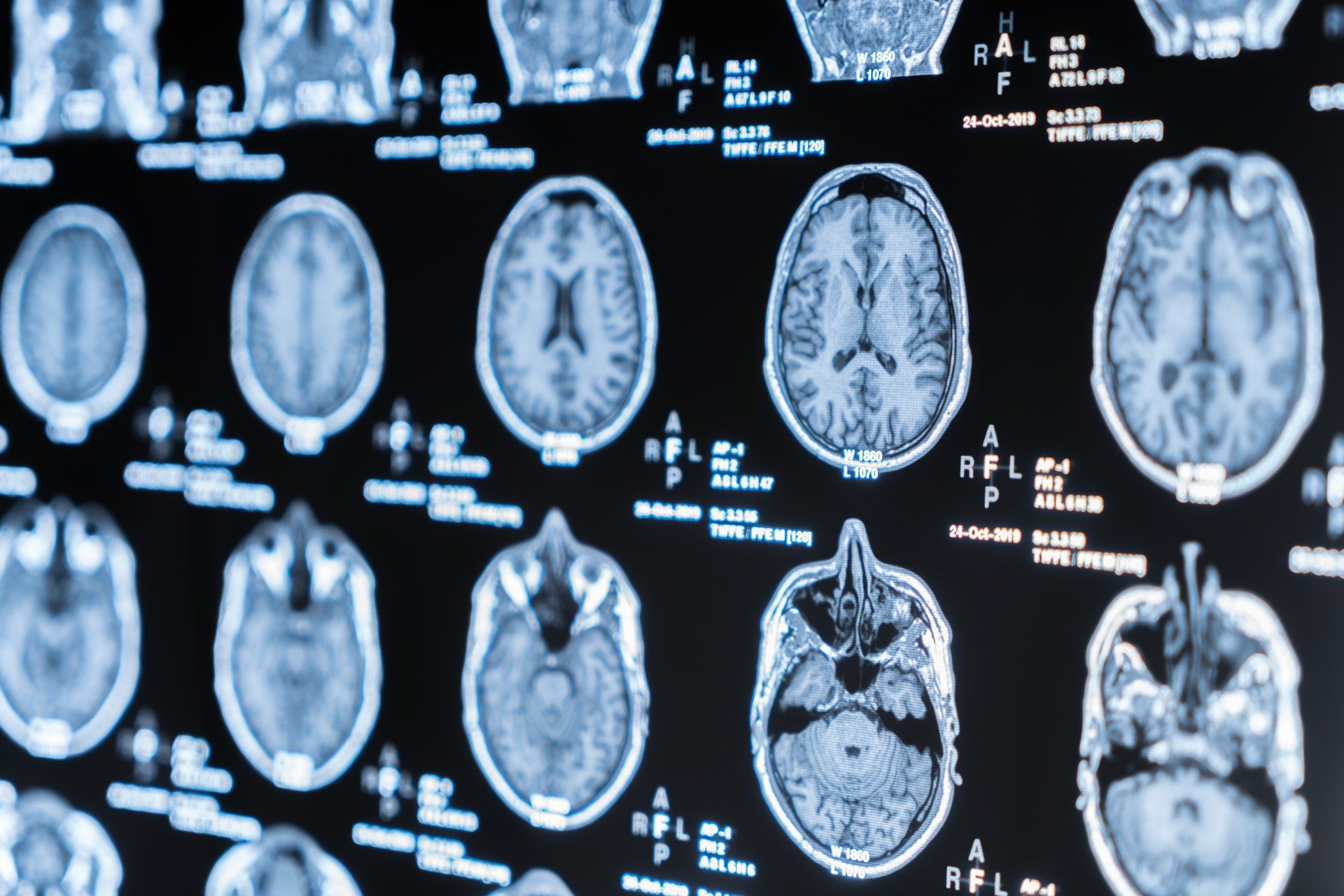 Neurocirurgião em Nova Iguaçu Médico neurocirurgião em Nova Iguaçu