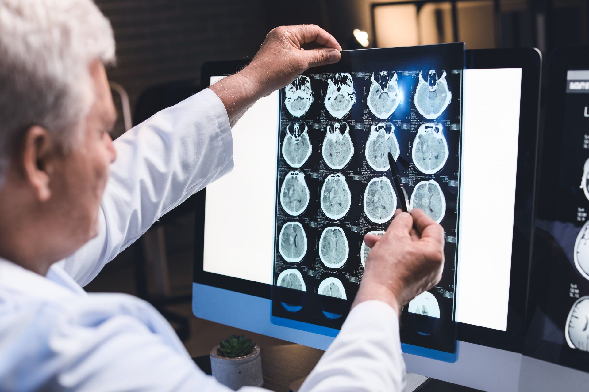 Diagnóstico de tumor cerebral no Rio de Janeiro