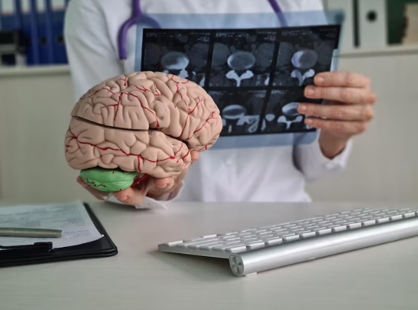 É possível sobreviver a um aneurisma cerebral?