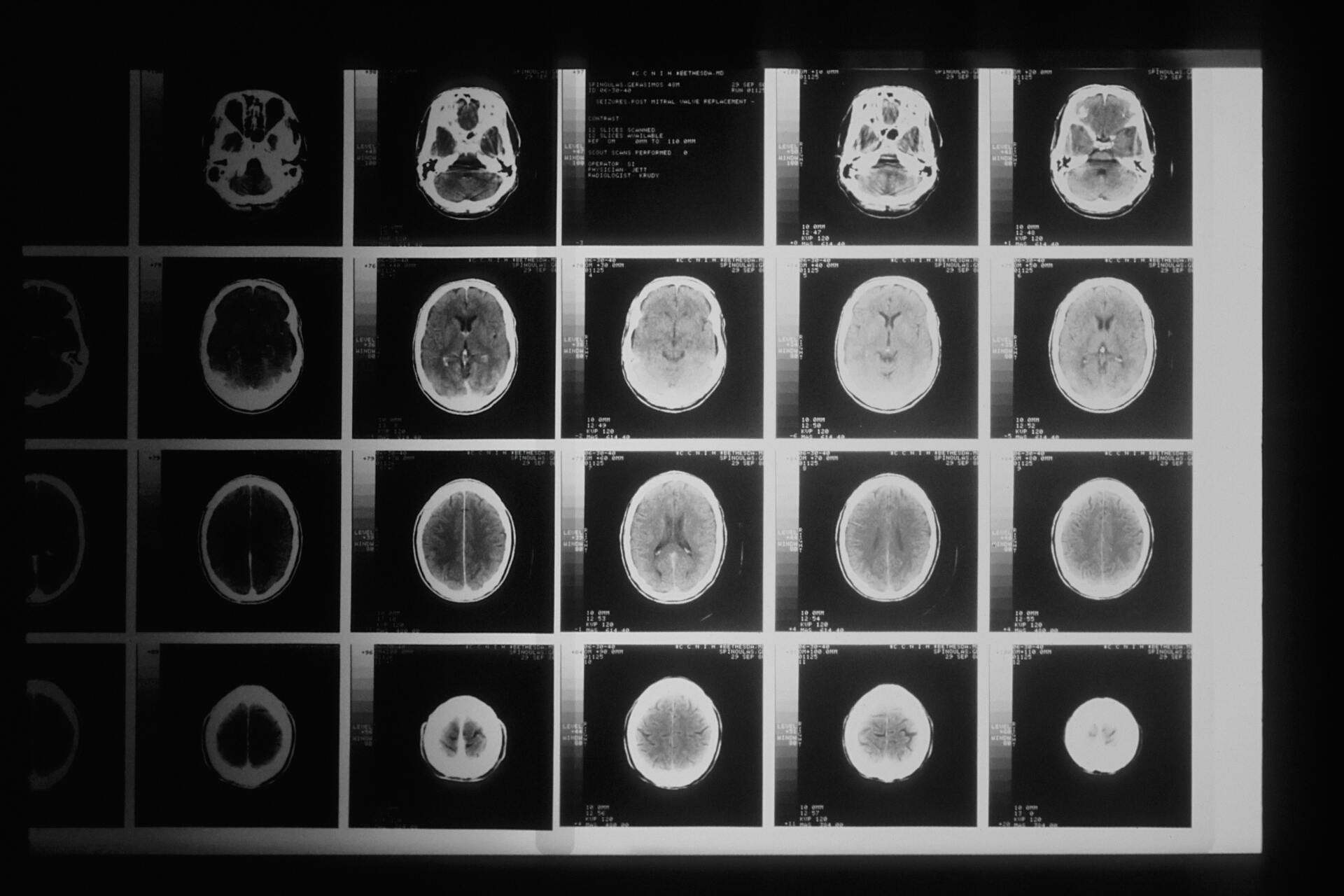 Neurocirurgião em São Cristóvão Neurocirurgião em São Cristóvão