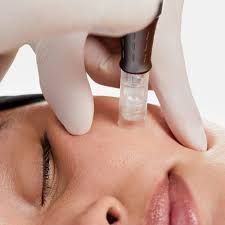 A woman is getting a microdermabrasion treatment on her face.