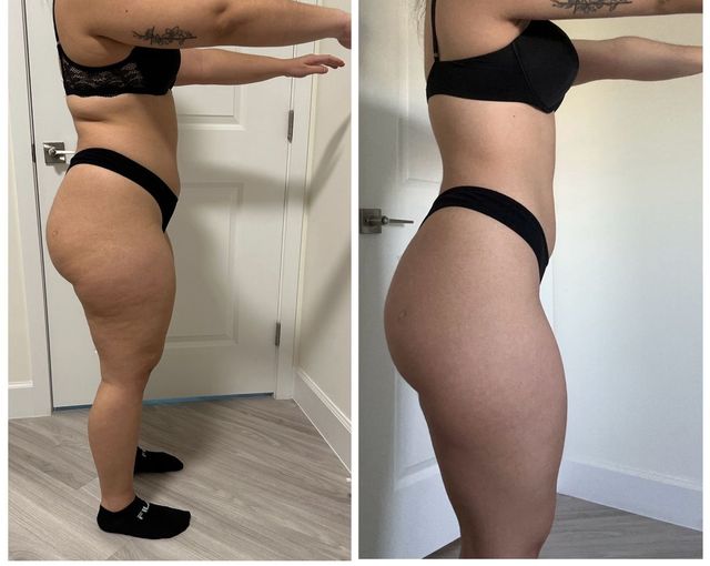 Side-by-side profile photos of a person in black underwear showing body shape before and after.