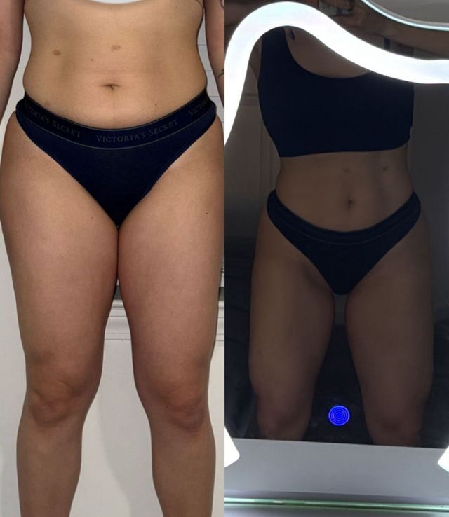 Side-by-side mirror photos of a person in dark underwear, showing front and angled views.
