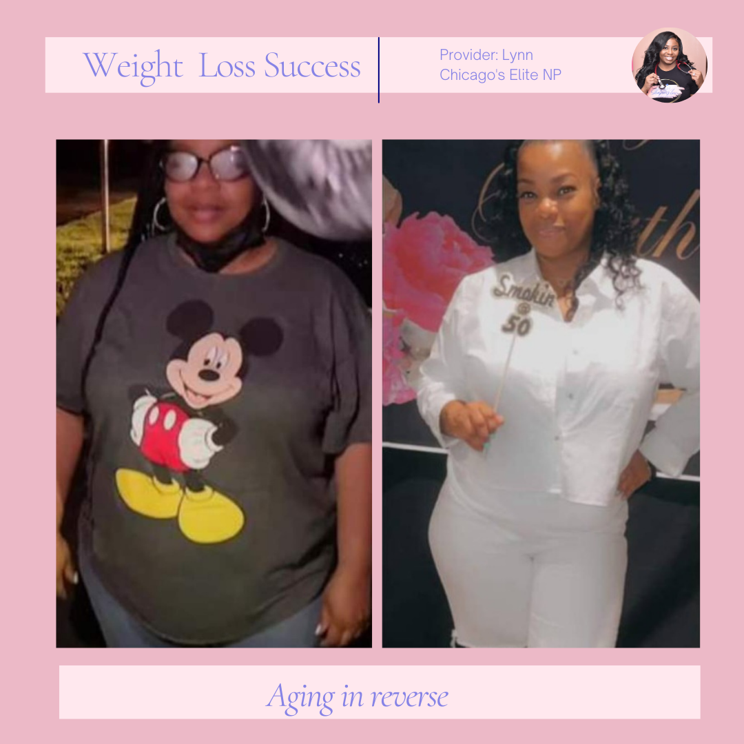 A woman wearing a mickey mouse shirt has lost weight