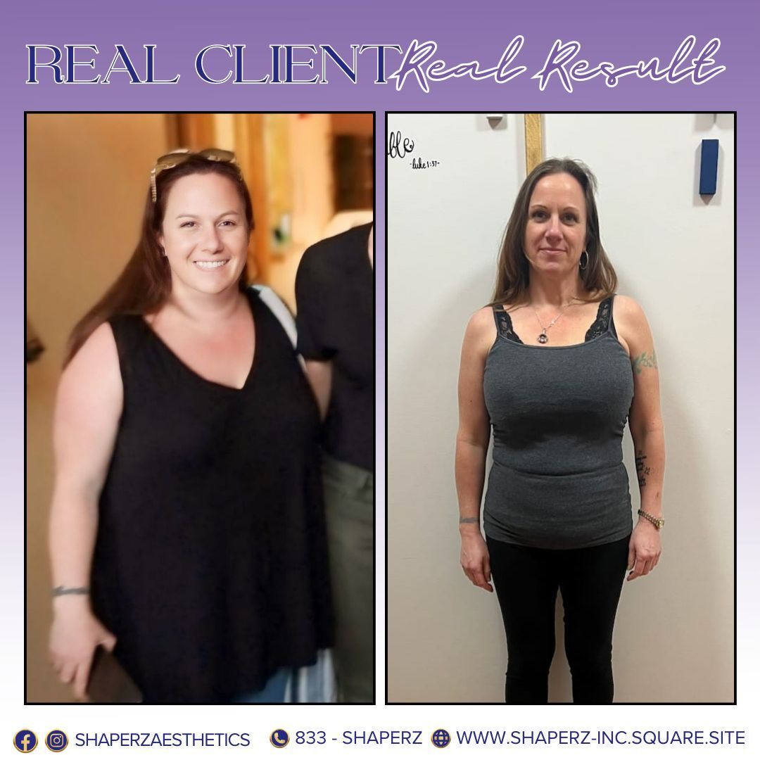 A picture of a woman before and after losing weight