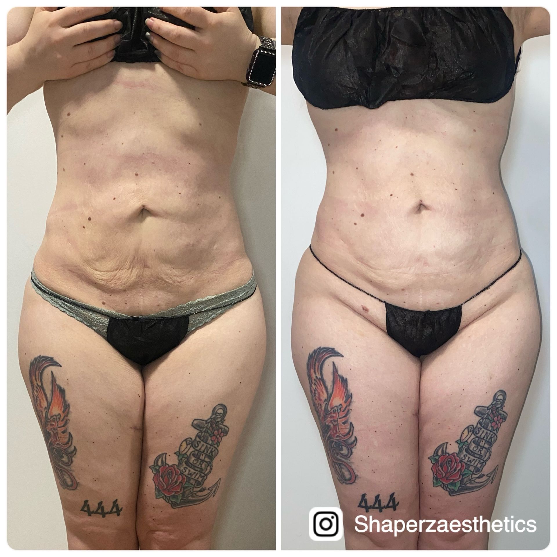 A before and after photo of a woman 's stomach and legs