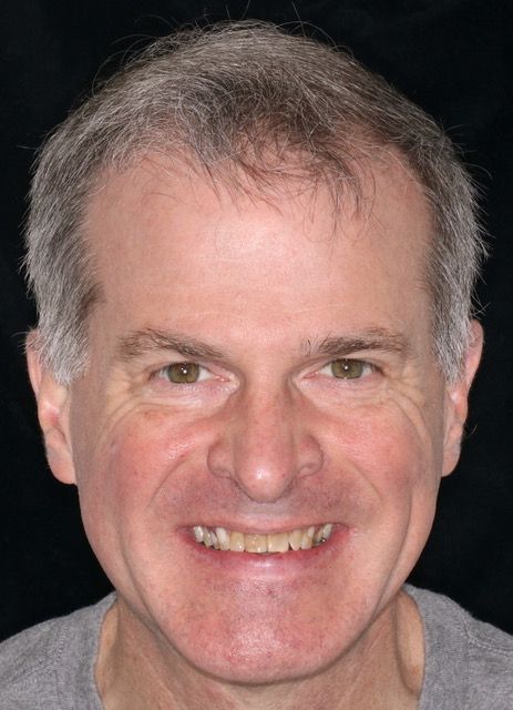 A close up of a man 's face with a smile on his face.