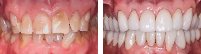 Montgomery Street Dental Before & After