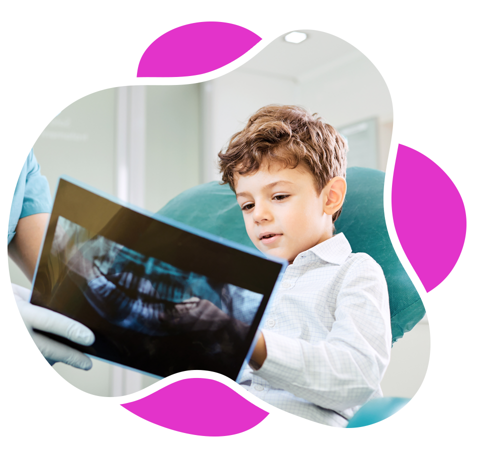 Digital X-rays | SuperSmiles Pediatric Dentistry