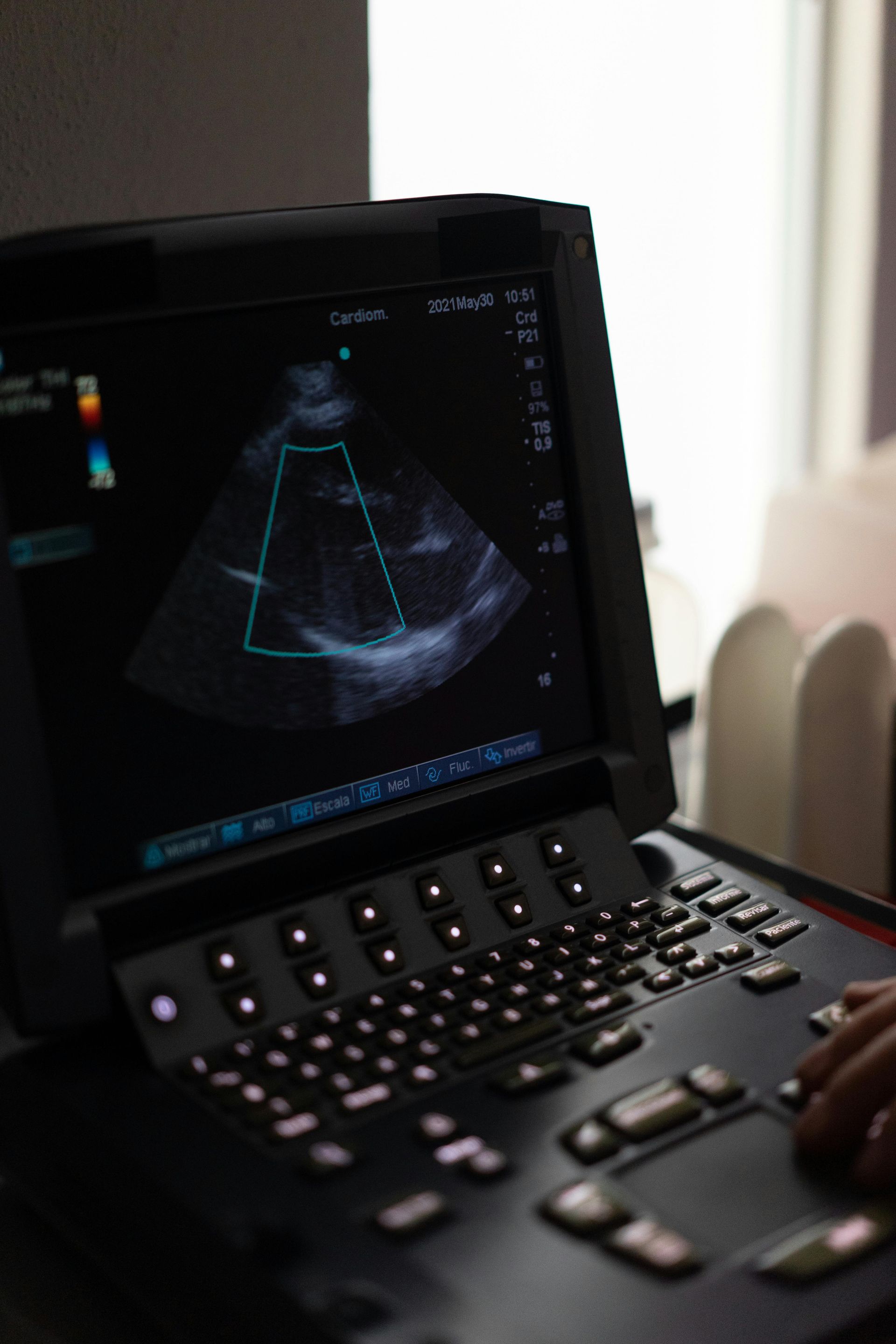 A person is using an ultrasound machine on a table.