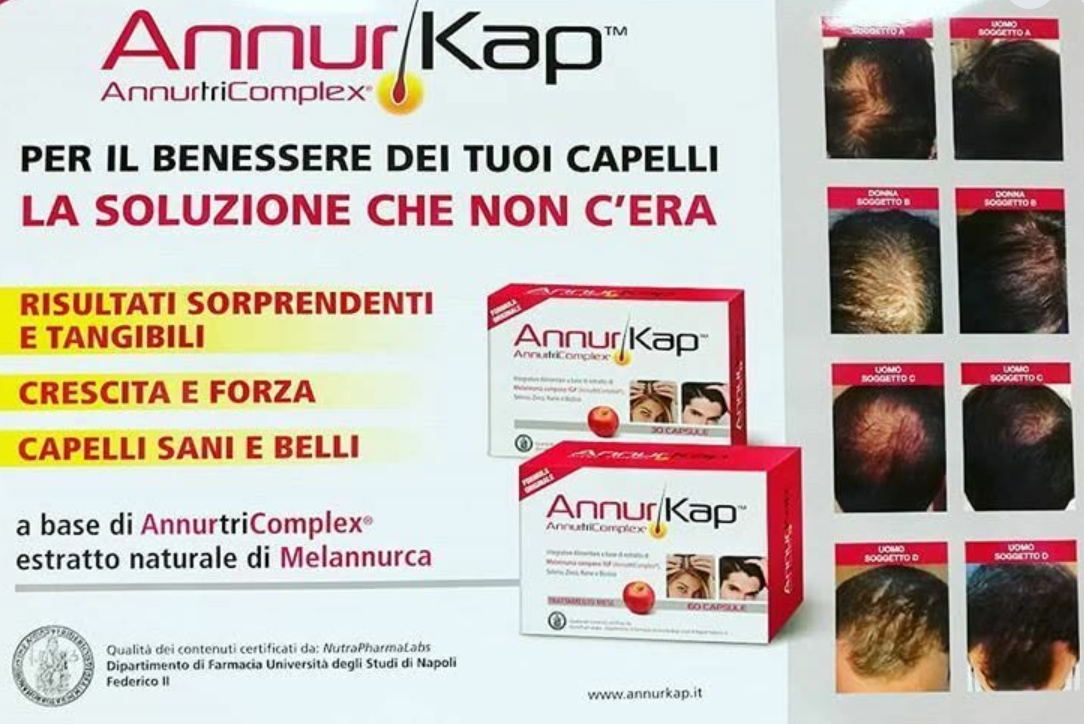 Pubblicità del trattamento anticaduta AnnurKap con confezione rossa e oro e foto del cuoio capelluto prima e dopo.