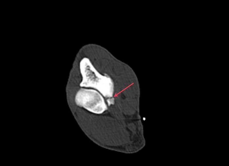 Elbow Dysplasia | Bridger Veterinary Specialists & Emergency