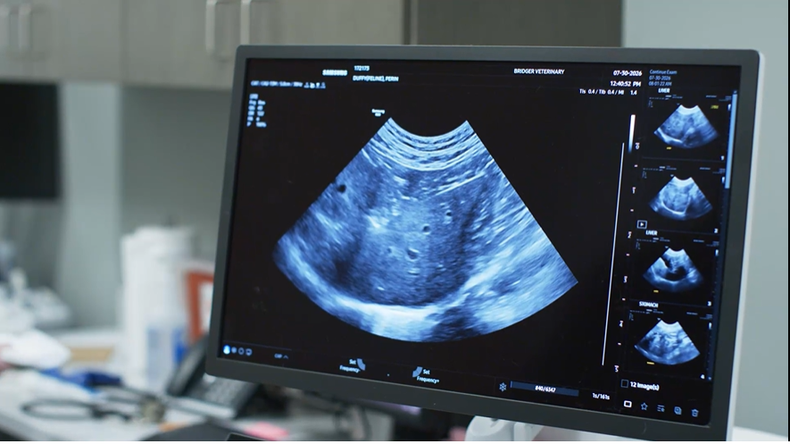 Ultrasound scan displayed on a monitor in a medical setting