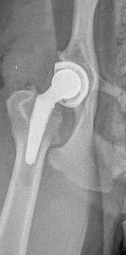 X-ray of a hip with a prosthetic joint implant visible in the socket and femur